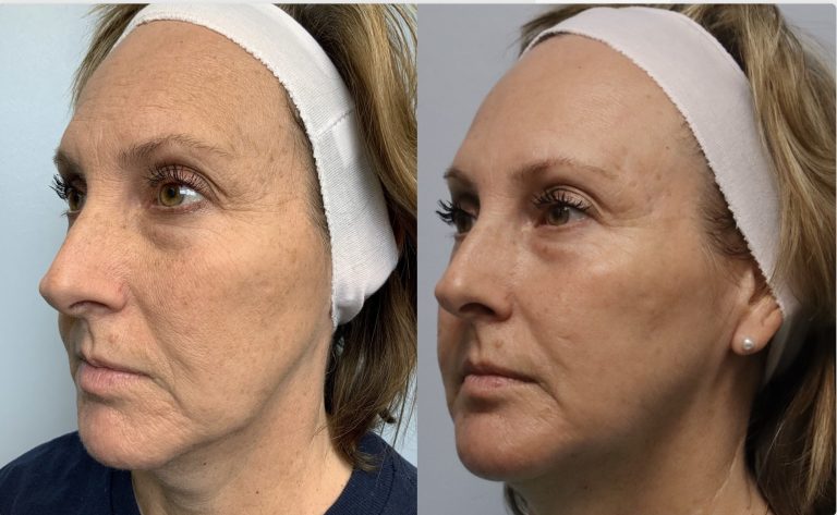 20240717_203507000_iOS